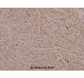 Anti-Stat6 (phospho-Y641) Antibody from Bioworld Technology (BS4187) - Antibodies.com