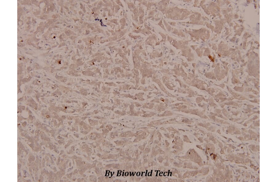 Anti-Stat6 (phospho-Y641) Antibody from Bioworld Technology (BS4187) - Antibodies.com