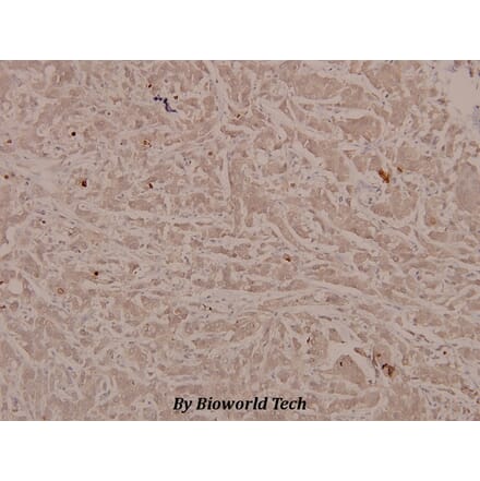 Anti-Stat6 (phospho-Y641) Antibody from Bioworld Technology (BS4187) - Antibodies.com
