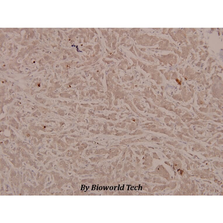 Anti-Stat6 (phospho-Y641) Antibody from Bioworld Technology (BS4187) - Antibodies.com