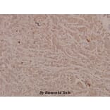 Anti-Stat6 (phospho-Y641) Antibody from Bioworld Technology (BS4187) - Antibodies.com