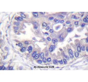 Anti-Syk (phospho-Y348) Antibody from Bioworld Technology (BS4188) - Antibodies.com