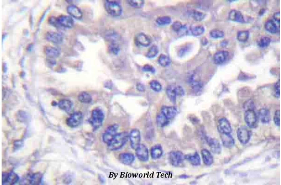 Anti-Syk (phospho-Y348) Antibody from Bioworld Technology (BS4188) - Antibodies.com