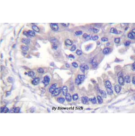 Anti-Syk (phospho-Y348) Antibody from Bioworld Technology (BS4188) - Antibodies.com