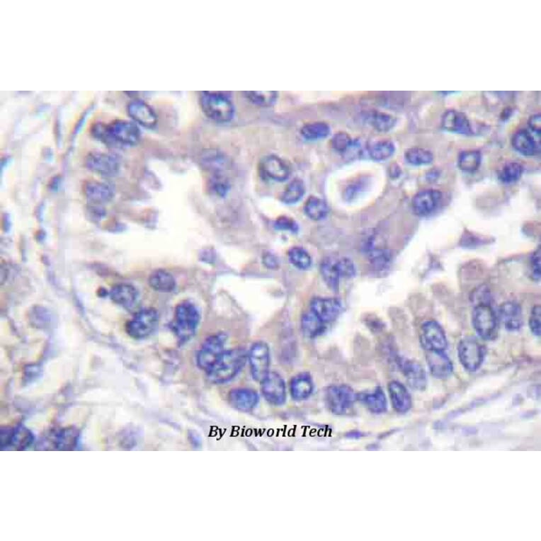 Anti-Syk (phospho-Y348) Antibody from Bioworld Technology (BS4188) - Antibodies.com