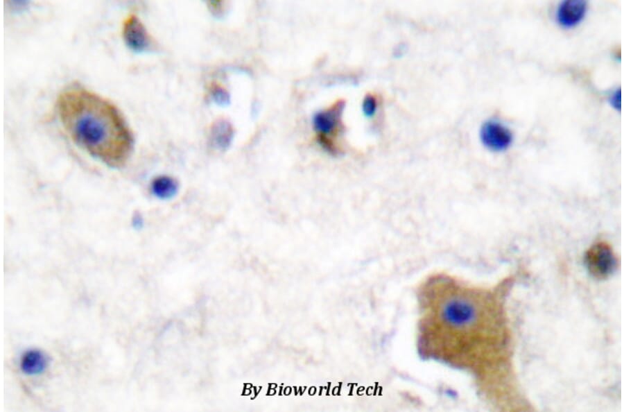Anti-Tau (phospho-S356) Antibody from Bioworld Technology (BS4195) - Antibodies.com