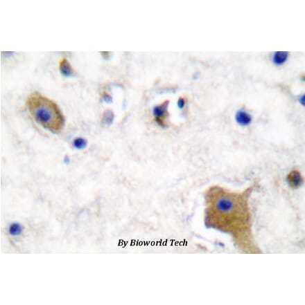 Anti-Tau (phospho-S356) Antibody from Bioworld Technology (BS4195) - Antibodies.com