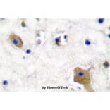 Anti-Tau (phospho-S356) Antibody from Bioworld Technology (BS4195) - Antibodies.com