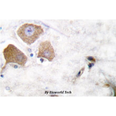 Anti-Tau (phospho-S396) Antibody from Bioworld Technology (BS4196) - Antibodies.com