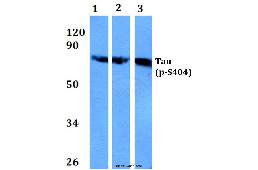Anti-Tau (phospho-S404) Antibody from Bioworld Technology (BS4197) - Antibodies.com
