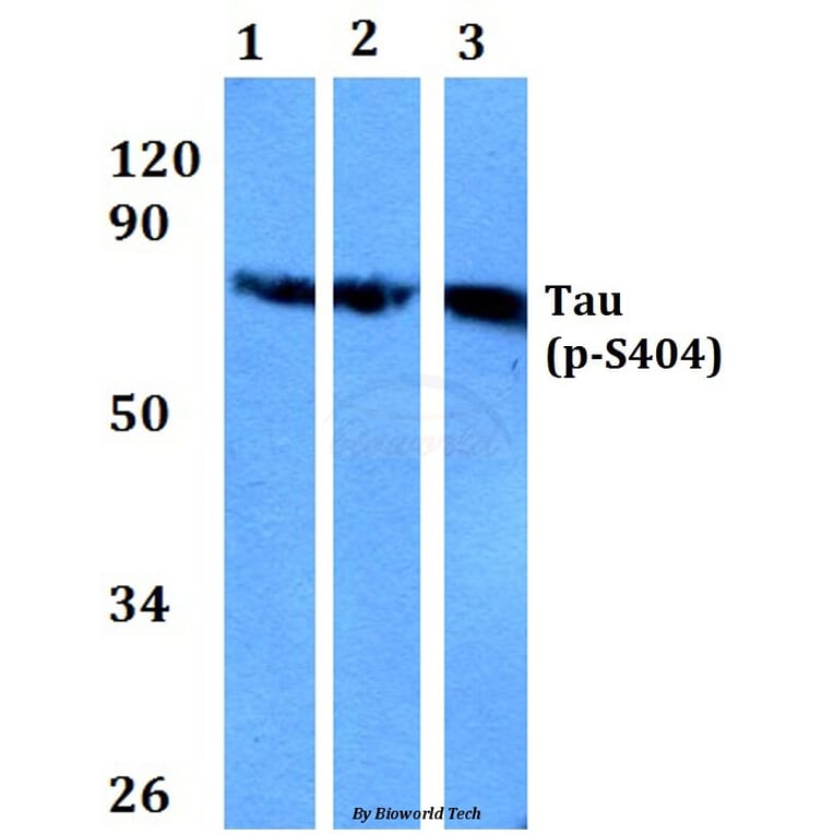 Anti-Tau (phospho-S404) Antibody from Bioworld Technology (BS4197) - Antibodies.com