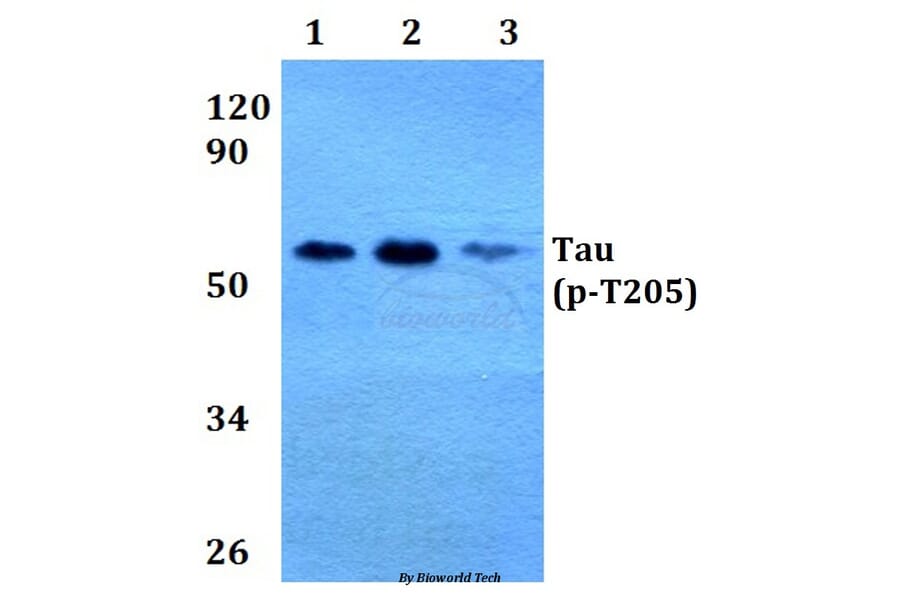 Anti-Tau (phospho-T205) Antibody from Bioworld Technology (BS4199) - Antibodies.com