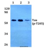 Anti-Tau (phospho-T205) Antibody from Bioworld Technology (BS4199) - Antibodies.com