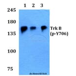 Anti-Trk B (phospho-Y706) Antibody from Bioworld Technology (BS4201) - Antibodies.com