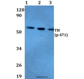 Anti-TH (phospho-S71) Antibody from Bioworld Technology (BS4203) - Antibodies.com