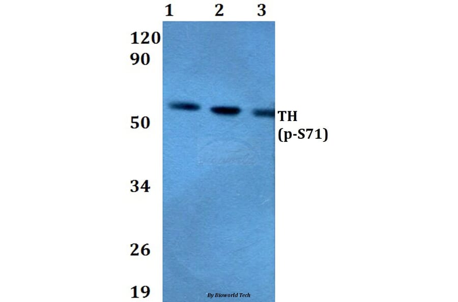 Anti-TH (phospho-S71) Antibody from Bioworld Technology (BS4203) - Antibodies.com
