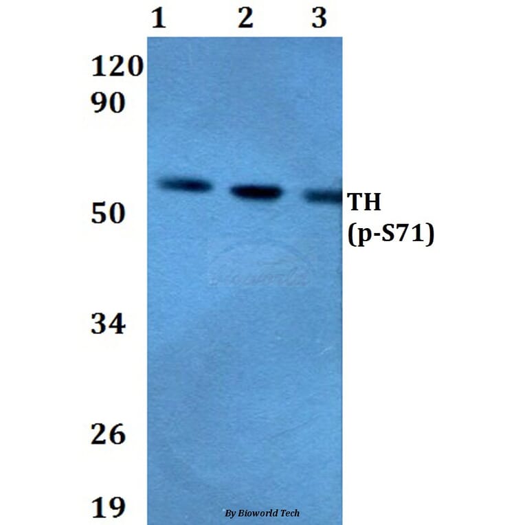 Anti-TH (phospho-S71) Antibody from Bioworld Technology (BS4203) - Antibodies.com