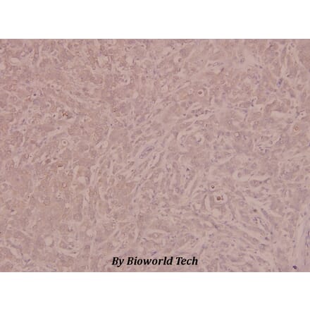 Anti-VEGFR2/Flk-1 (phospho-Y1175) Antibody from Bioworld Technology (BS4205) - Antibodies.com
