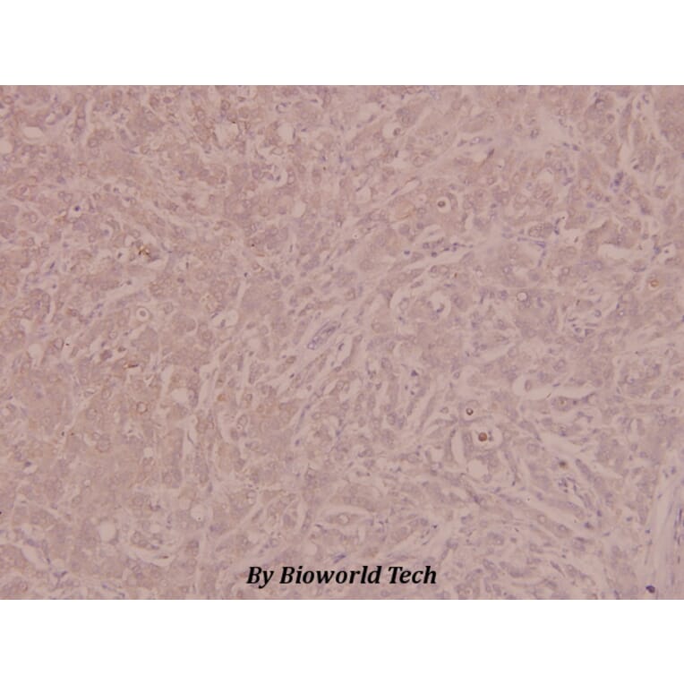 Anti-VEGFR2/Flk-1 (phospho-Y1175) Antibody from Bioworld Technology (BS4205) - Antibodies.com