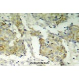 Anti-VEGFR2/Flk-1 (phospho-Y1214) Antibody from Bioworld Technology (BS4206) - Antibodies.com