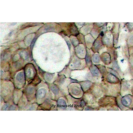 Anti-VEGFR2/Flk-1 (phospho-Y951) Antibody from Bioworld Technology (BS4207) - Antibodies.com