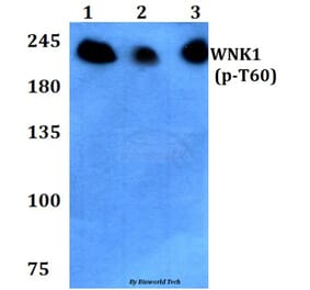 Anti-WNK1 (phospho-T60) Antibody from Bioworld Technology (BS4208) - Antibodies.com