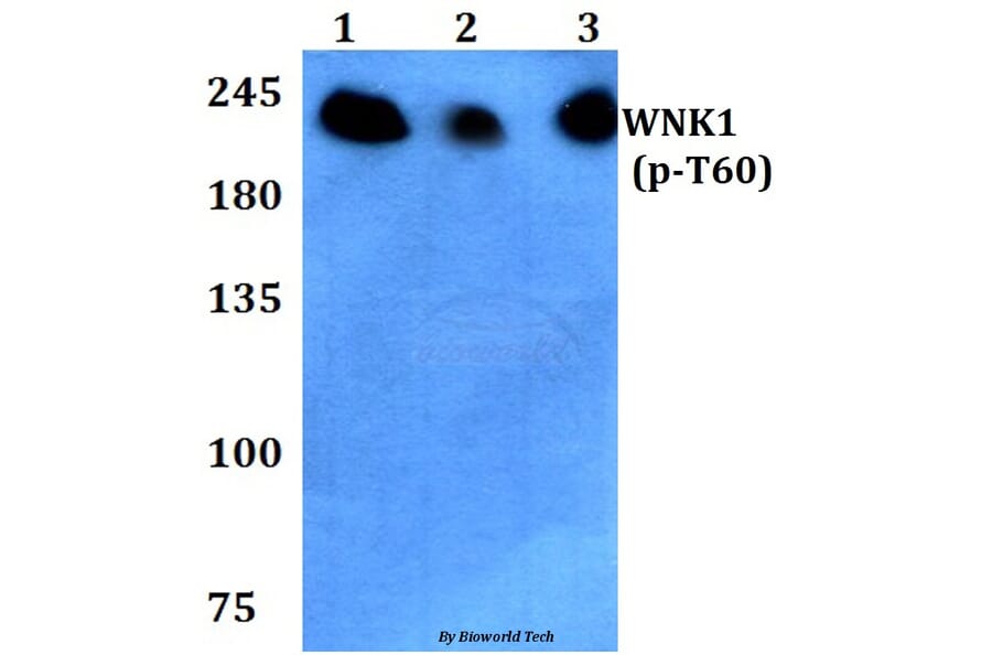 Anti-WNK1 (phospho-T60) Antibody from Bioworld Technology (BS4208) - Antibodies.com