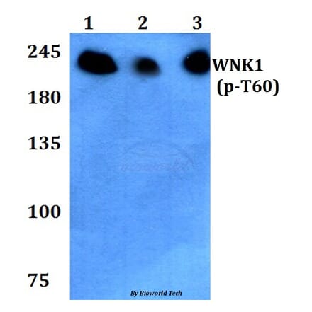 Anti-WNK1 (phospho-T60) Antibody from Bioworld Technology (BS4208) - Antibodies.com
