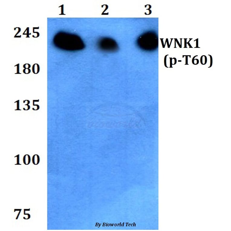 Anti-WNK1 (phospho-T60) Antibody from Bioworld Technology (BS4208) - Antibodies.com