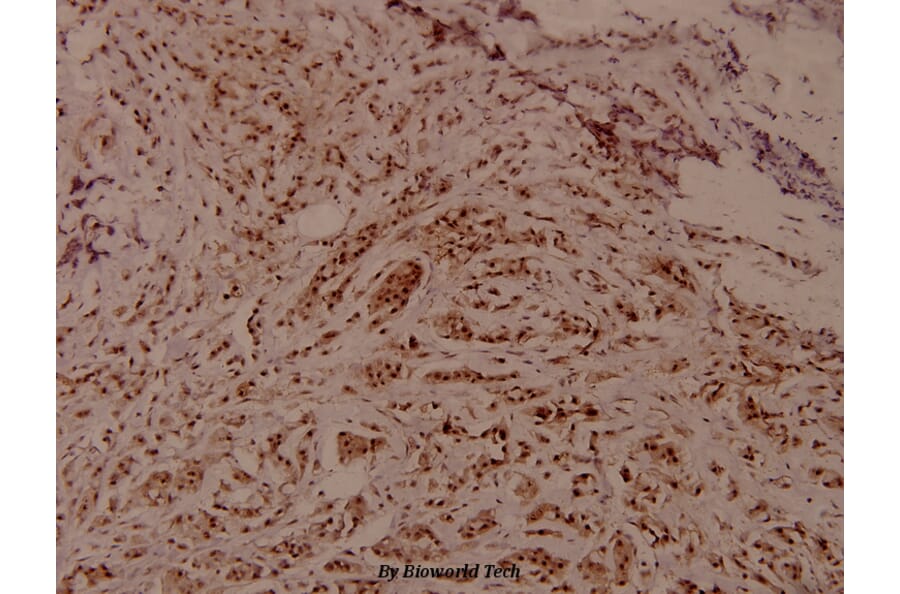 Anti-WNK1 (phospho-T60) Antibody from Bioworld Technology (BS4208) - Antibodies.com