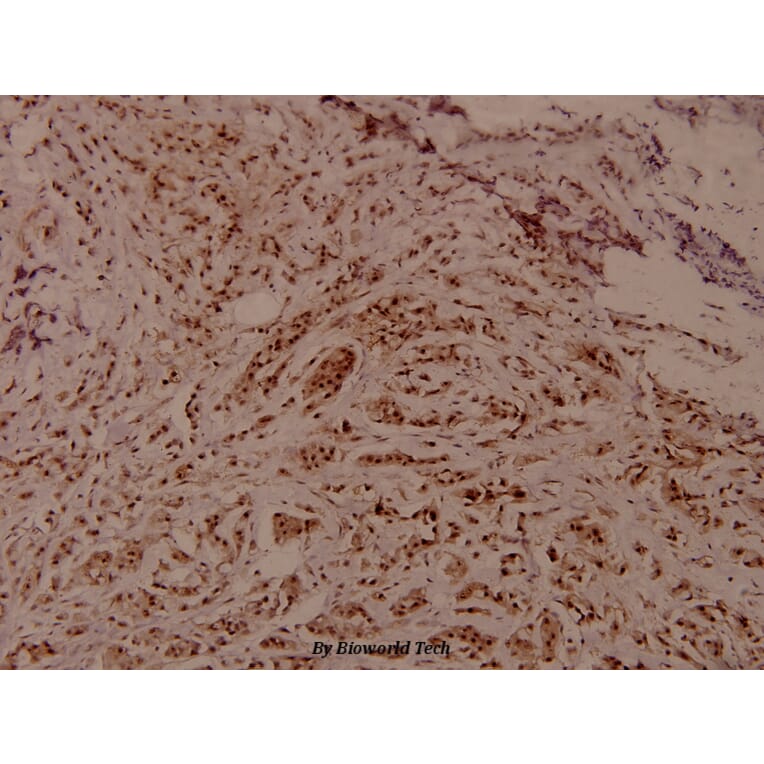 Anti-WNK1 (phospho-T60) Antibody from Bioworld Technology (BS4208) - Antibodies.com