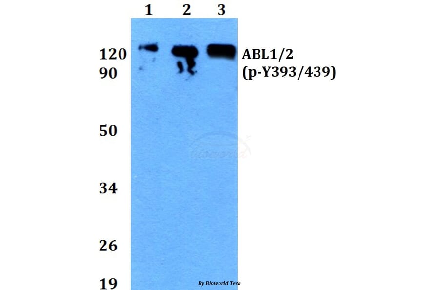 Anti-ABL1/2 (phospho-Y393/439) Antibody from Bioworld Technology (BS4209) - Antibodies.com