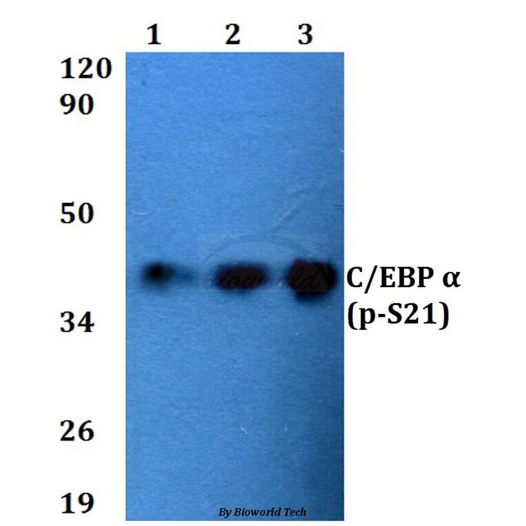 Anti-C/EBP α (phospho-S21) Antibody from Bioworld Technology (BS4217) - Antibodies.com