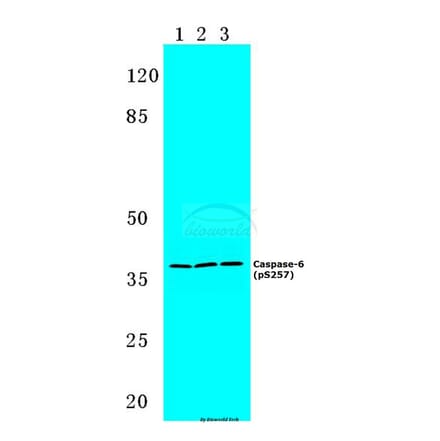 Anti-Caspase-6 (phospho-S257) Antibody from Bioworld Technology (BS4219) - Antibodies.com