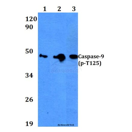 Anti-Caspase-9 (phospho-T125) Antibody from Bioworld Technology (BS4221) - Antibodies.com