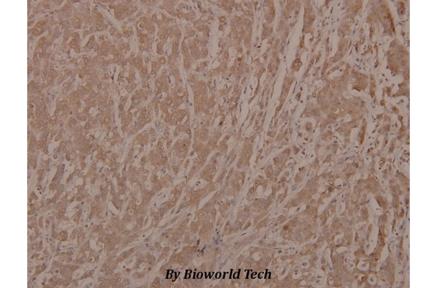 Anti-Bad (phospho-S112) Antibody from Bioworld Technology (BS4222) - Antibodies.com