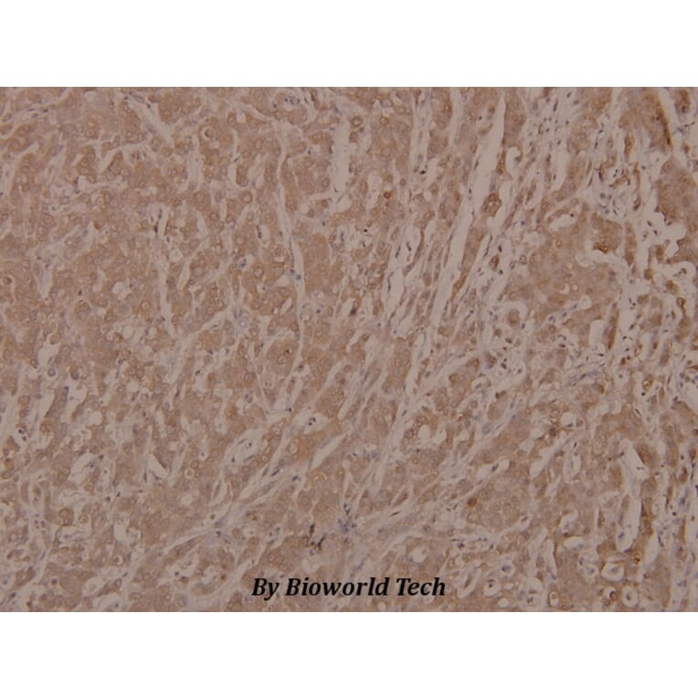 Anti-Bad (phospho-S112) Antibody from Bioworld Technology (BS4222) - Antibodies.com