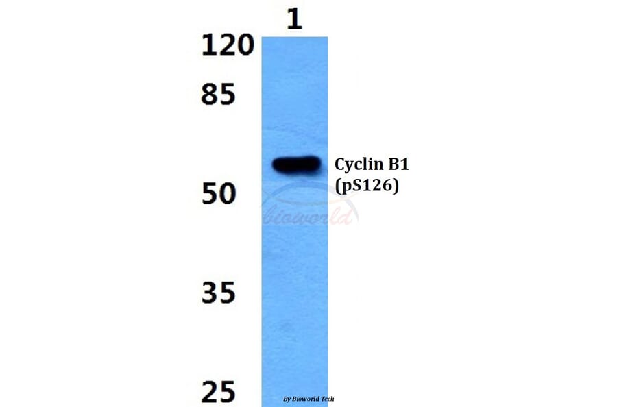 Anti-Cyclin B1 (phospho-S126) Antibody from Bioworld Technology (BS4225) - Antibodies.com