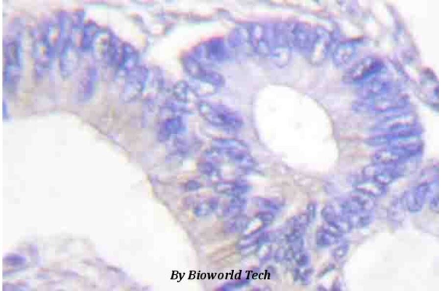 Anti-HSL (phospho-S855) Antibody from Bioworld Technology (BS4234) - Antibodies.com