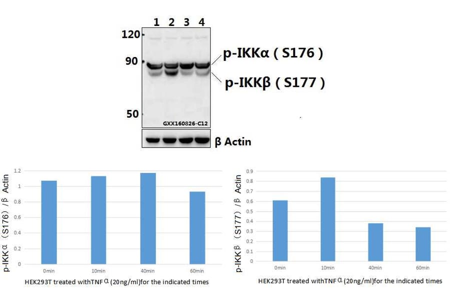 Anti-IKKα/β (phospho-S176/177) Antibody from Bioworld Technology (BS4236) - Antibodies.com
