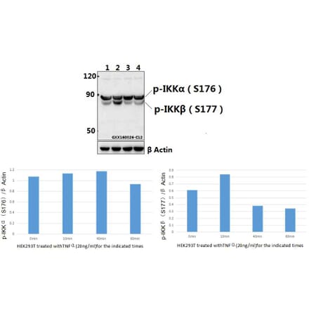 Anti-IKKα/β (phospho-S176/177) Antibody from Bioworld Technology (BS4236) - Antibodies.com
