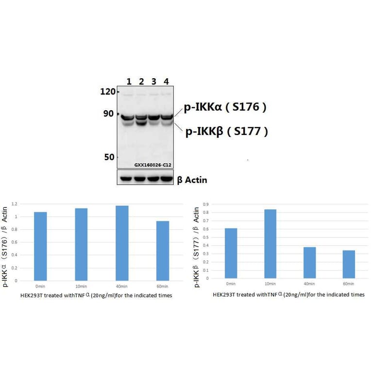 Anti-IKKα/β (phospho-S176/177) Antibody from Bioworld Technology (BS4236) - Antibodies.com