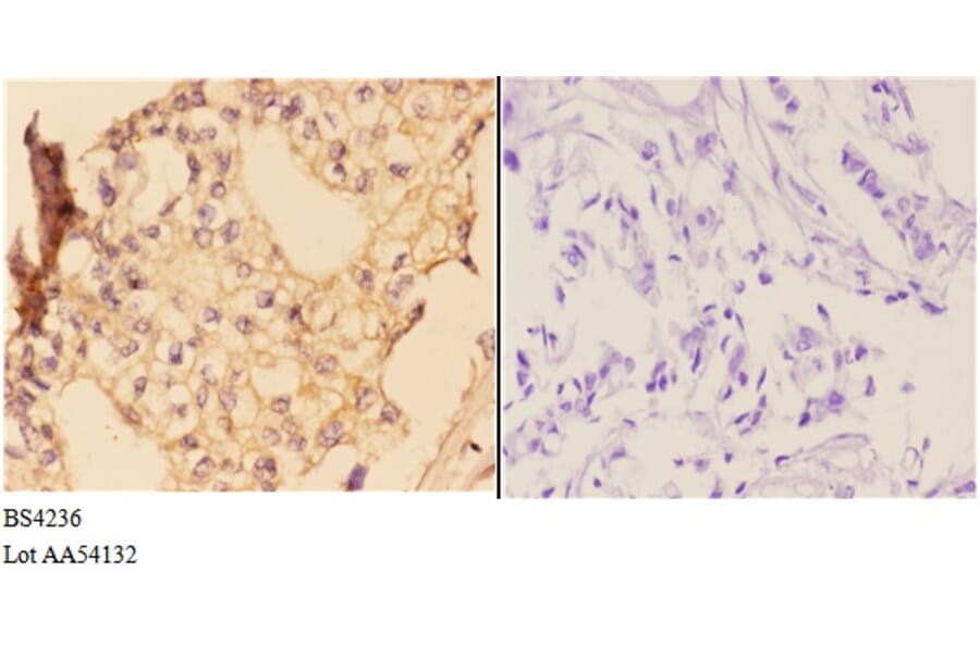 Anti-IKKα/β (phospho-S176/177) Antibody from Bioworld Technology (BS4236) - Antibodies.com