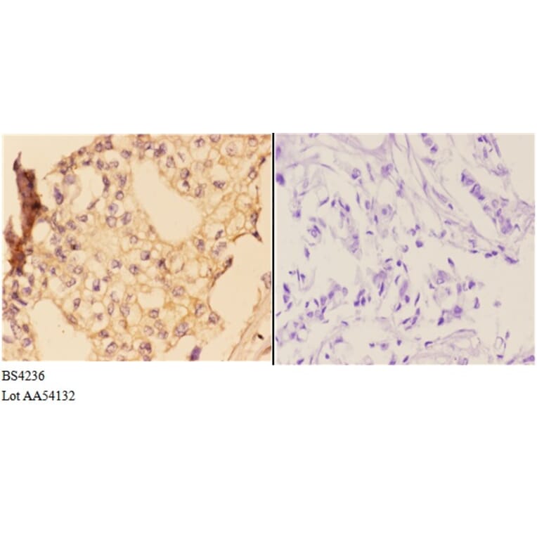 Anti-IKKα/β (phospho-S176/177) Antibody from Bioworld Technology (BS4236) - Antibodies.com