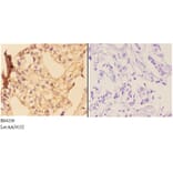 Anti-IKKα/β (phospho-S176/177) Antibody from Bioworld Technology (BS4236) - Antibodies.com