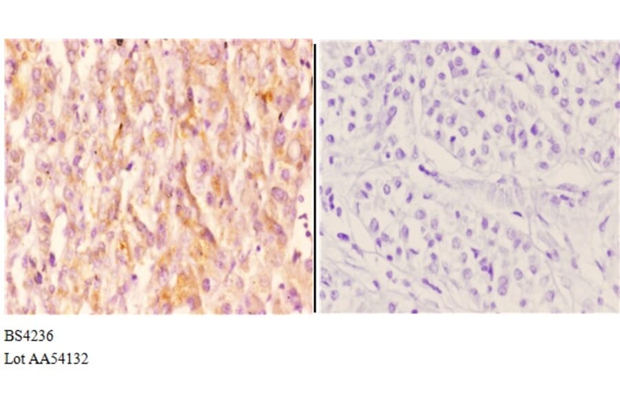 Anti-IKKα/β (phospho-S176/177) Antibody from Bioworld Technology (BS4236) - Antibodies.com