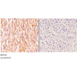 Anti-IKKα/β (phospho-S176/177) Antibody from Bioworld Technology (BS4236) - Antibodies.com