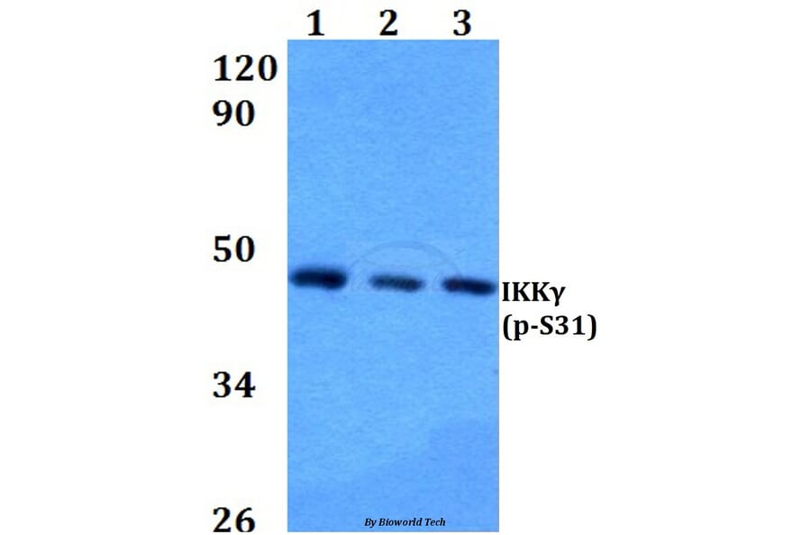 Anti-IKKγ (phospho-S31) Antibody from Bioworld Technology (BS4238) - Antibodies.com