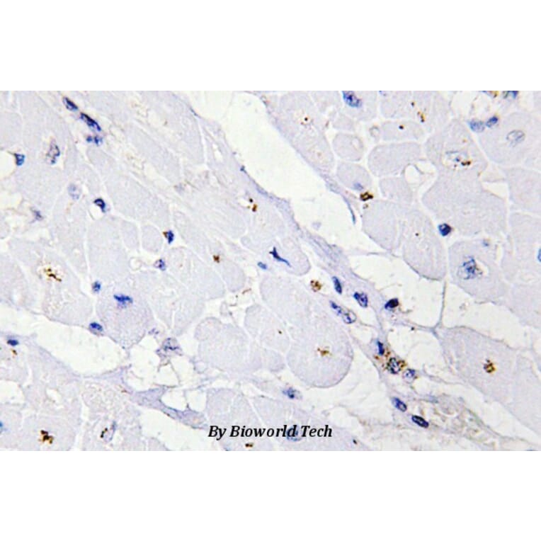 Anti-IKKγ (phospho-S31) Antibody from Bioworld Technology (BS4238) - Antibodies.com