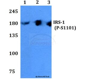 Anti-IRS-1 (phospho-S1101) Antibody from Bioworld Technology (BS4239) - Antibodies.com